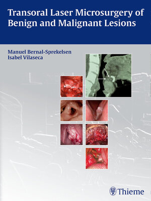 cover image of Transoral Laser Microsurgery of Benign and Malignant Lesions